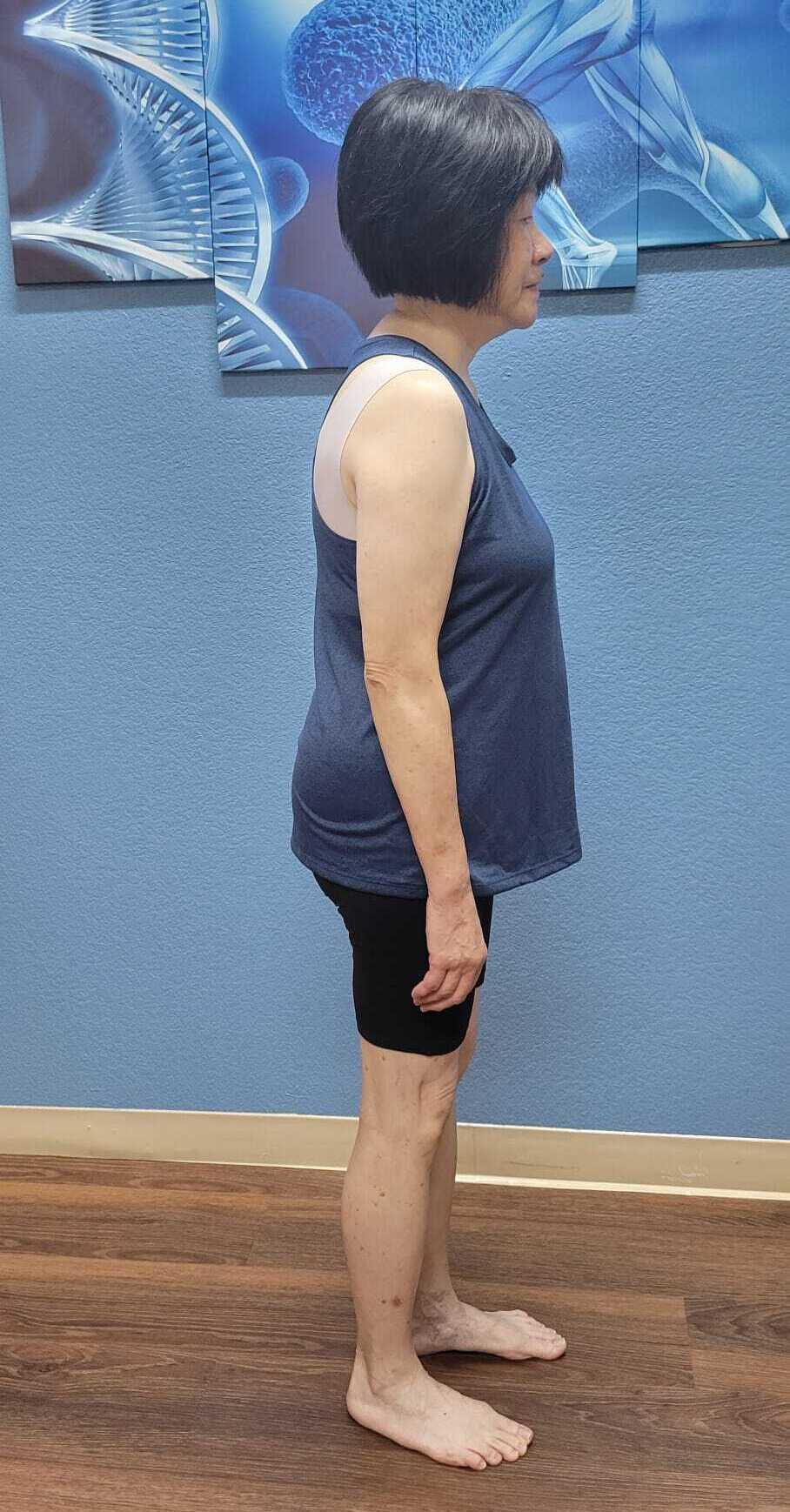 Posture Correction